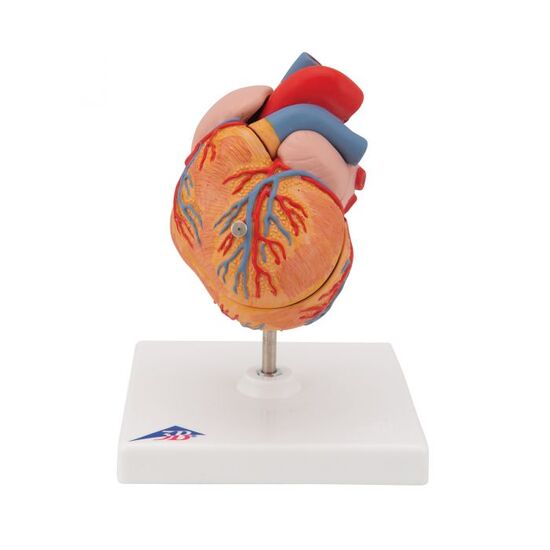 Classic Human Heart Model with Left Ventricular Hypertrophy (LVH), 2 part – 3B Smart Anatomy