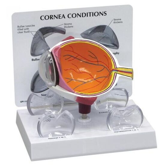 Cornea Eye Cross Section