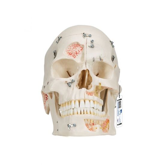 Deluxe Human Demonstration Dental Skull Model, 10 part – 3B Smart Anatomy