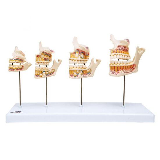 Dentition Development Model – 3B Smart Anatomy