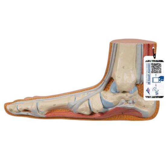 Flat Foot (Pes Planus) Model – 3B Smart Anatomy