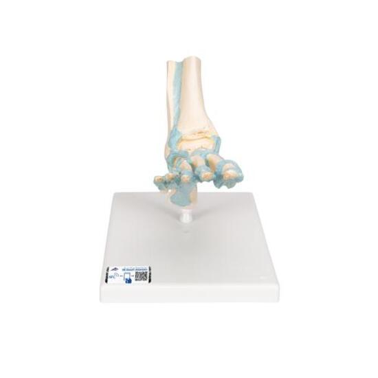 Foot Skeleton Model with Ligaments – 3B Smart Anatomy