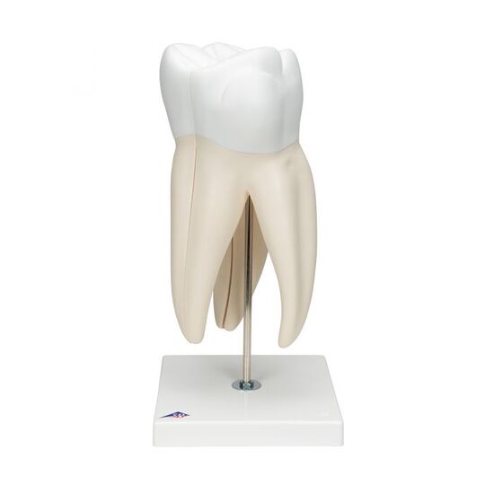 Giant Molar with Dental Cavities Human Tooth Model, 15 times Life-Size, 6 part – 3B Smart Anatomy
