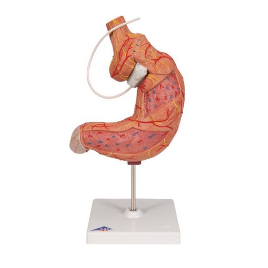 Human Stomach Model with Gastric Band, 2 part – 3B Smart Anatomy