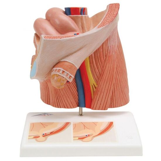 Inguinal Hernia Urology Model – 3B Smart Anatomy