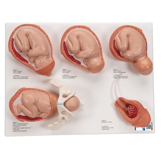 Labor Stages Model, Small – 3B Smart Anatomy