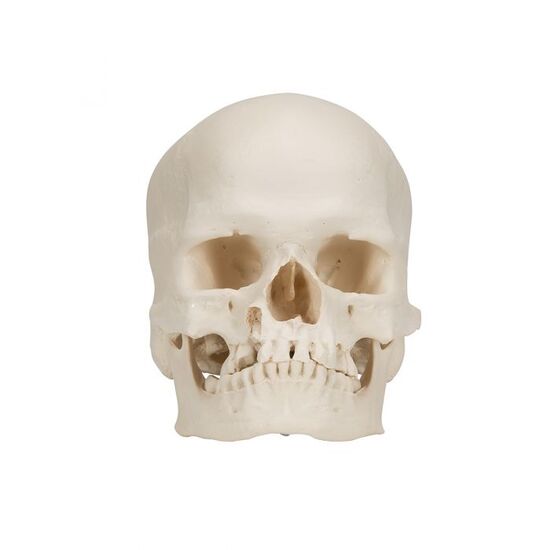 Microcephalic Human Skull Model