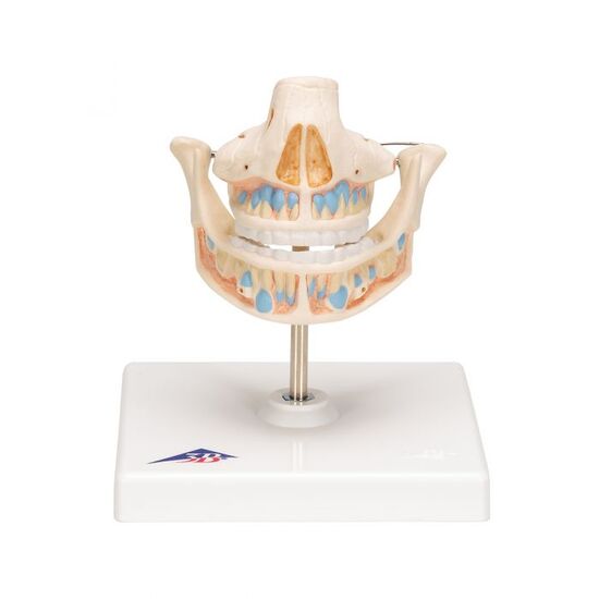 Milk Denture Model with Remaining Teeth – 3B Smart Anatomy
