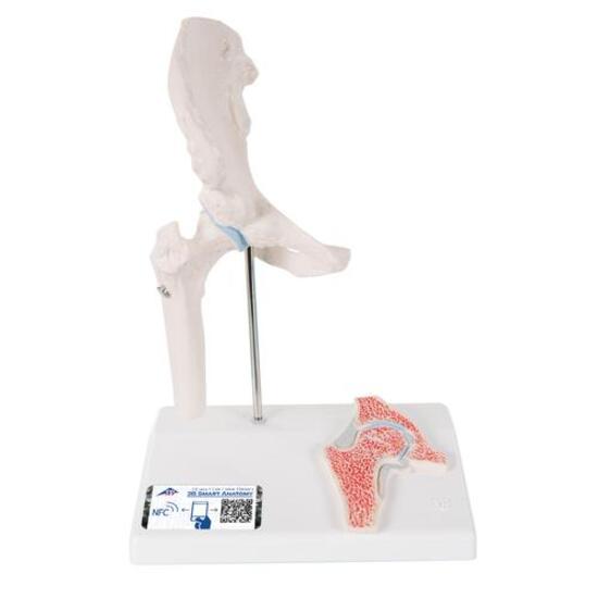 Mini Human Hip Joint Model with Cross Section – 3B Smart Anatomy