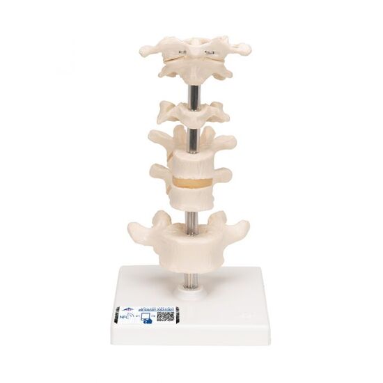 Model of 6 Human Vertebrae, Mounted on Stand (atlas, axis, cervical, 2x thoracic, lumbar) - 3B Smart Anatomy