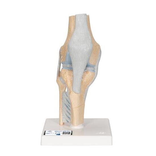 Sectional Human Knee Joint Model, 3 part - 3B Smart Anatomy