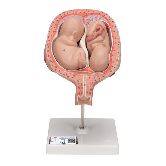 Twin Fetuses Model, 5th Month in Normal Position – 3B Smart Anatomy