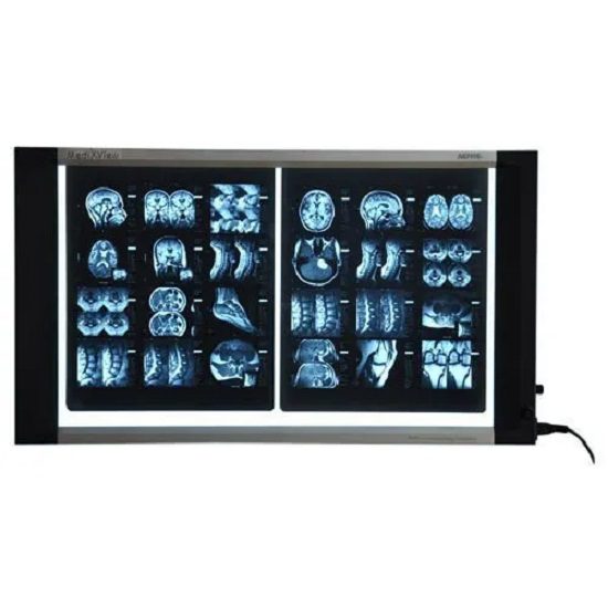 Led X Ray Viewing Screen