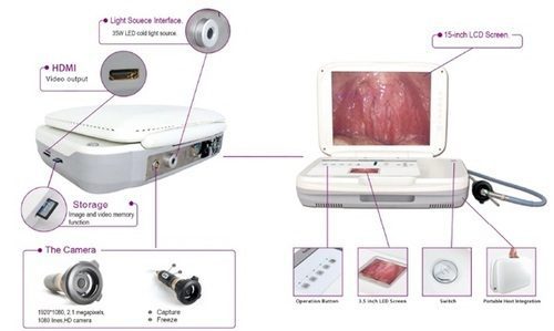 Complete Endoscopy System