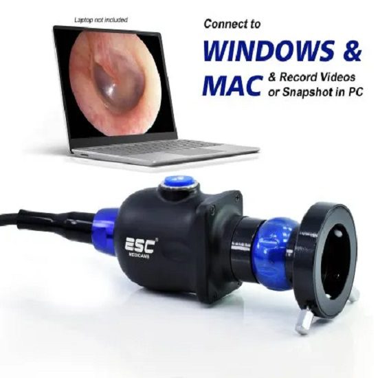 Portable HD USB Endoscopy Camera for ENT for Laptop / PC