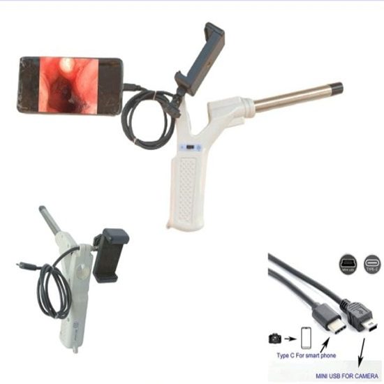 Suneye Pro Video Proctoscope with USB Camera & Biopsy Channel